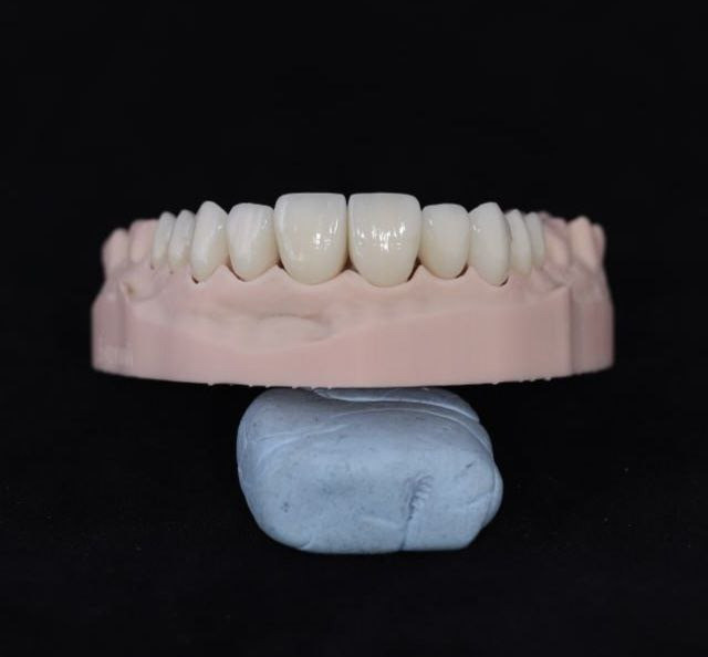 Зуботехнічні роботи для всієї України: фрезерування оксиду цирконію, композитів та воску, Е.мах. Київ - зображення 7