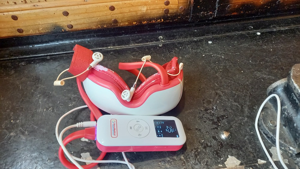 Массажёр для глаз Novumedical NovuEye Запоріжжя - зображення 1