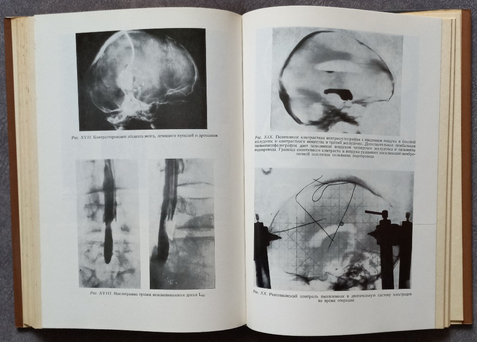 Основы нейрохирургии. Э. Пастор Харьков - изображение 5