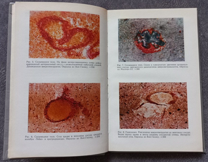 Легкая закрытая черепно-мозговая травма. Курако Ю.Л. Букина В.В. Харьков - изображение 4