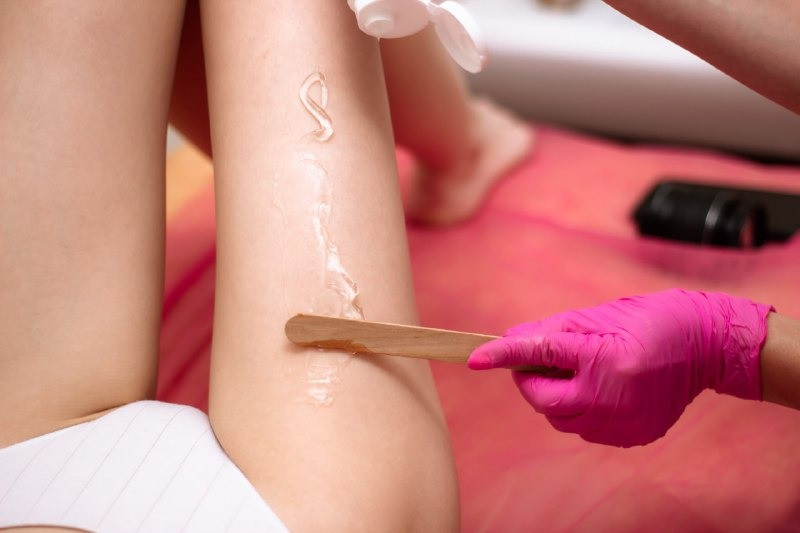 Лазерная эпиляция ног в Каменском! Київ - зображення 1