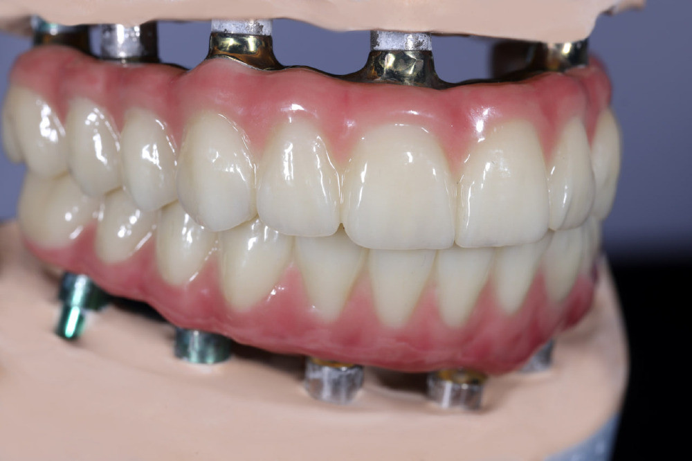 Зуботехнічні роботи для всієї України: фрезерування оксиду цирконію, композитів та воску, Е.мах. Київ - зображення 5