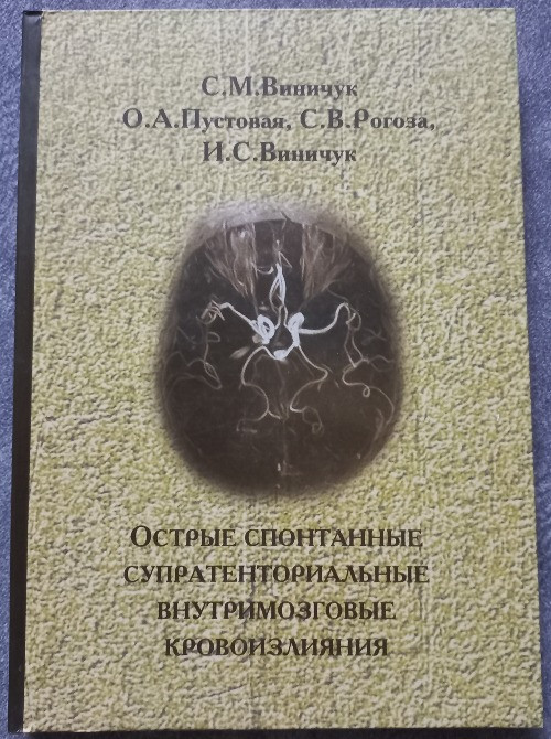 Острые спонтанные супратенториальные внутримозговые кровоизлияния. Винничук С.М., Пустовая О.А., Рог Харків - зображення 1