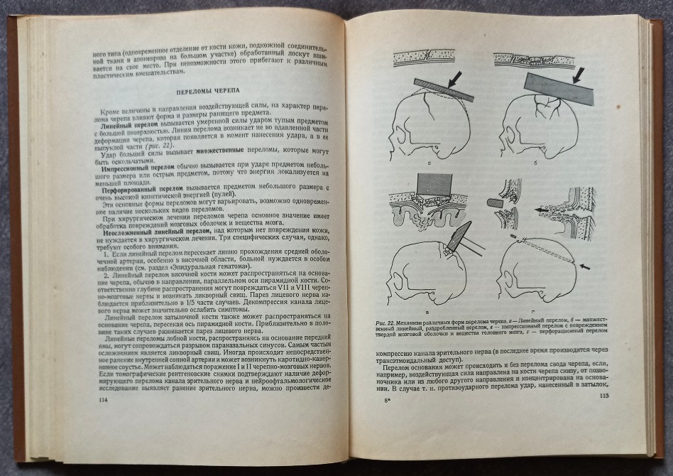 Основы нейрохирургии. Э. Пастор Харьков - изображение 6