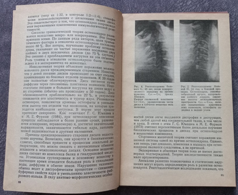 Вестибулярные и слуховые нарушения при шейном остеохондрозе В.И. Бабияк, Г.А. Акимов, В.Г. Базаров, Харьков - изображение 5