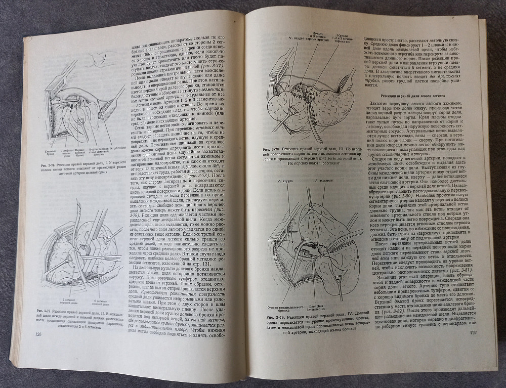Оперативная хирургия под общей редакцией проф. И. Литтманна Харків - зображення 4