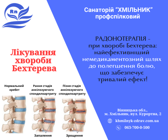 Лікування хвороби Бехтерева у санаторії «Хмільник» Хмельник