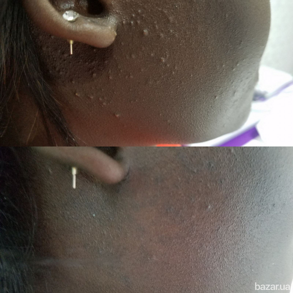 Врач дерматолог-косметолог Киев, метро Харьковская Київ - зображення 2