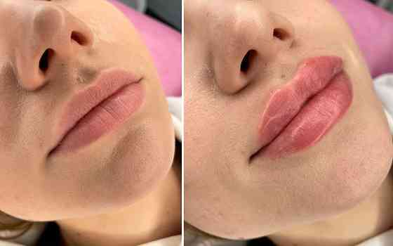 Контурування губ - вирівнювання і збільшення Киев