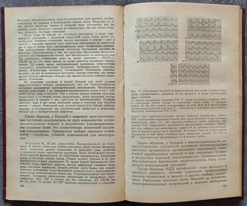Головная боль. В.Н. Шток Харьков - изображение 4
