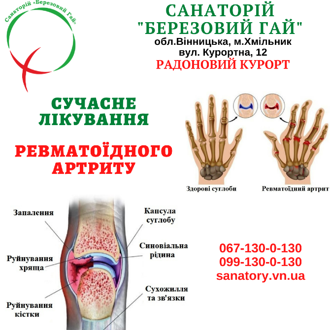 Лікування ревматоїдного артриту в санаторії "Березовий гай" Вінниця - зображення 1
