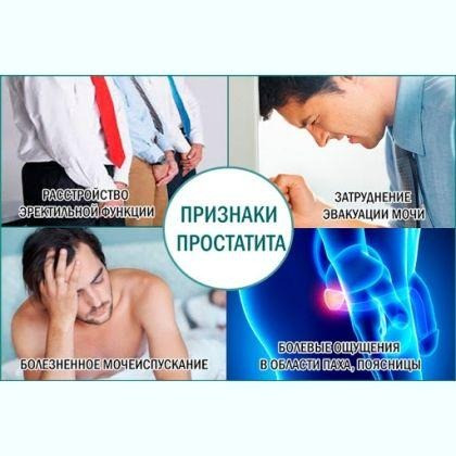 Массаж простаты Супер Предложение - Супер Скидки на Курс Киев - изображение 2