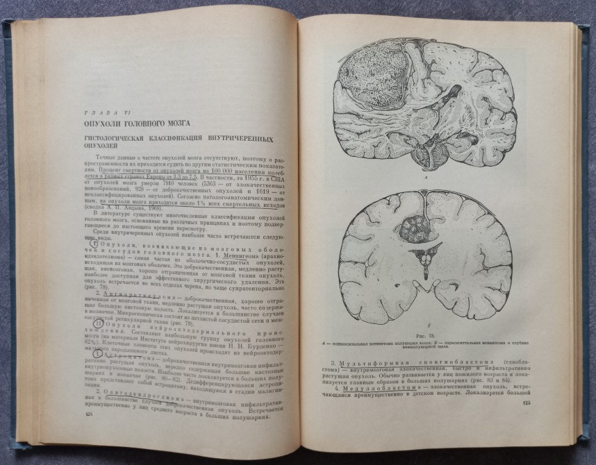 Нейрохирургия. И.М. Иргер Харків - зображення 6