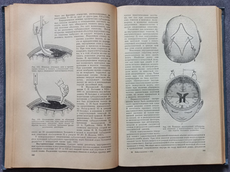 Нейрохирургия. И.М. Иргер Харків - зображення 7