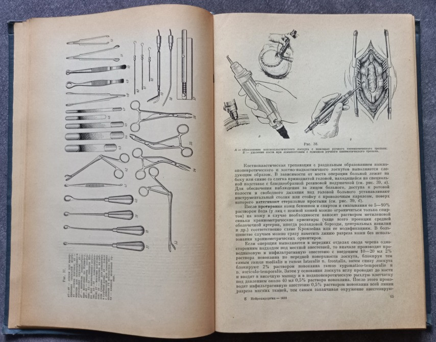 Нейрохирургия. И.М. Иргер Харків - зображення 5