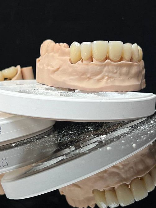 Зуботехнічні роботи для всієї України: фрезерування оксиду цирконію, композитів та воску, Е.мах. Київ - зображення 1