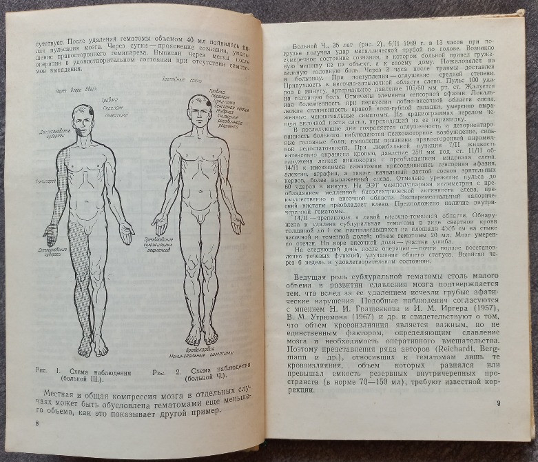 Травматические внутричерепные гематомы. Л.Б. Лихтерман, Л.Х. Хитрин Харьков - изображение 5