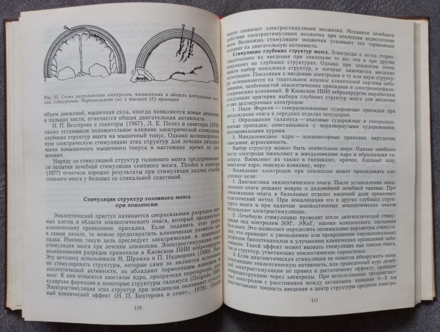Оперативные вмешательства при заболеваниях головного мозга под редакцией Ю.А. Зозули Харьков - изображение 5