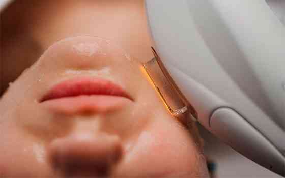 Професійний Smas-ліфтинг у місті Київ (Солом'янка і Дарниця) Київ