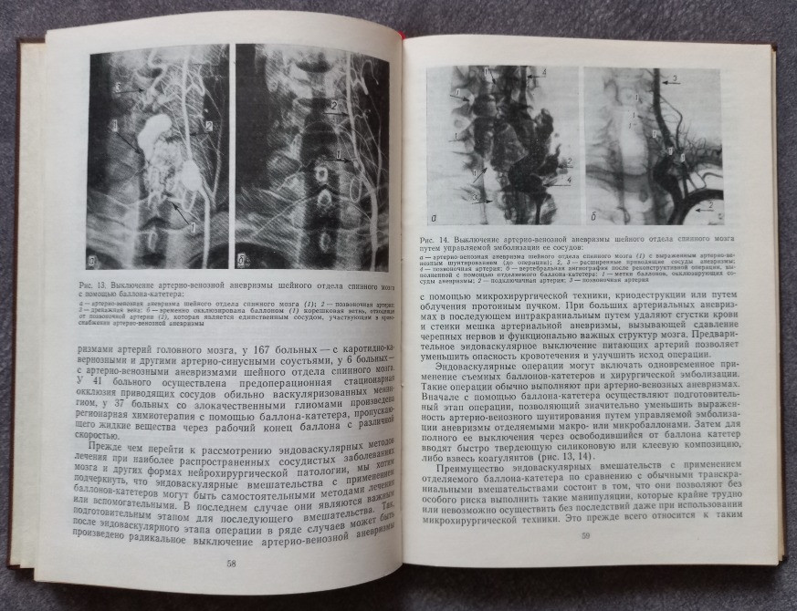Оперативные вмешательства при заболеваниях головного мозга под редакцией Ю.А. Зозули Харьков - изображение 4