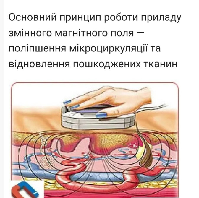 Аппарат магнитотерапии Novator MAG-30-4 Запоріжжя - зображення 5