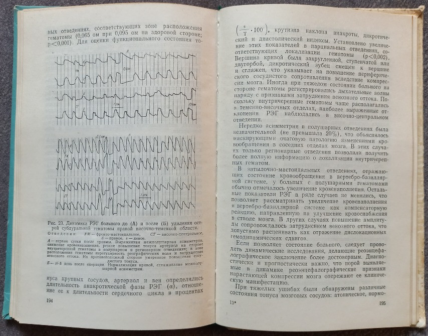 Травматические внутричерепные гематомы. Л.Б. Лихтерман, Л.Х. Хитрин Харьков - изображение 7