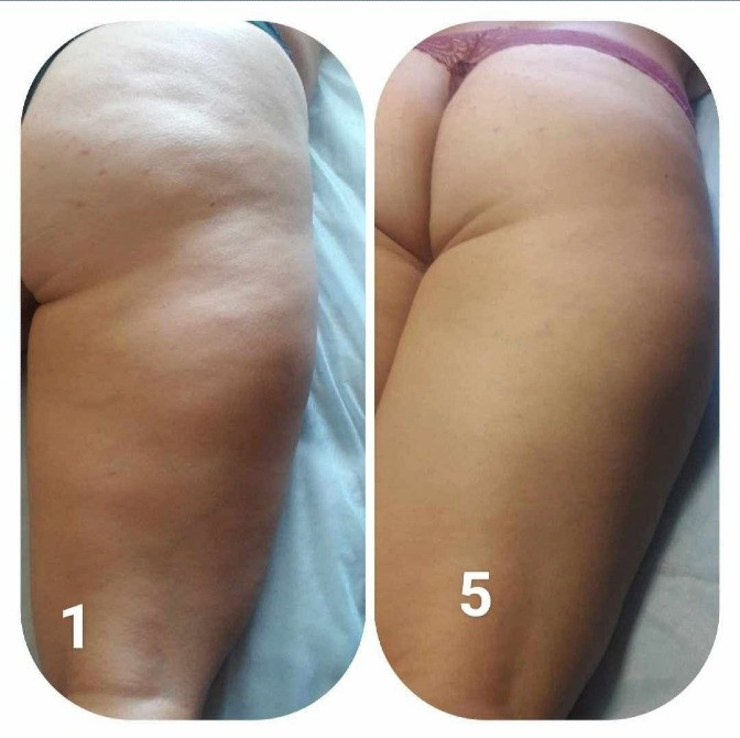 Масаж оздоровчий, релакс , креольський, медовий Біла Церква - зображення 2