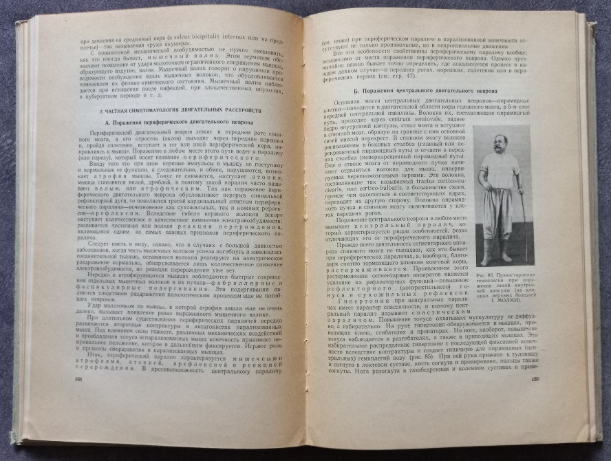 Нервные болезни. Е. К. Сепп, М. Б. Цукер, Е. В. Шмидт Харків - зображення 6