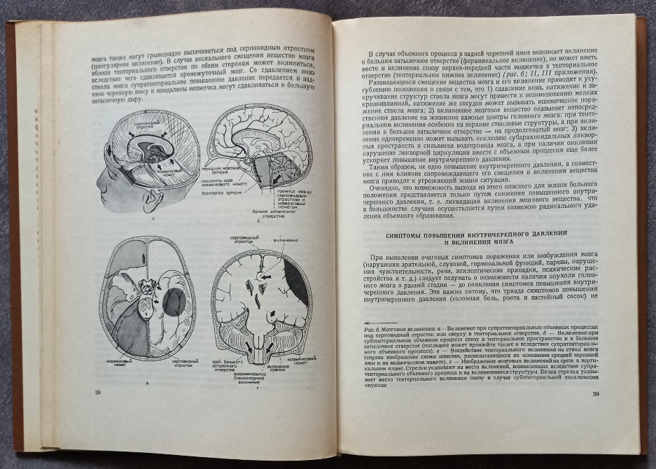 Основы нейрохирургии. Э. Пастор Харьков - изображение 4