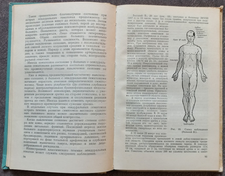 Травматические внутричерепные гематомы. Л.Б. Лихтерман, Л.Х. Хитрин Харьков - изображение 6