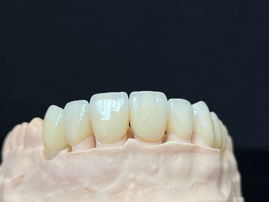 Зуботехнічні роботи для всієї України: фрезерування оксиду цирконію, композитів та воску, Е.мах. Київ - зображення 3