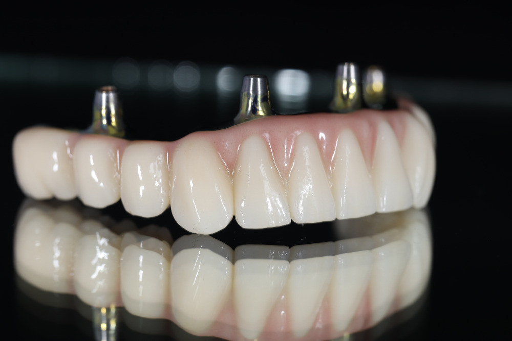 Зуботехнічні роботи для всієї України: фрезерування оксиду цирконію, композитів та воску, Е.мах. Київ - зображення 2