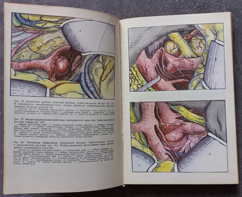 Сосудистая нейрохирургия. Ромоданов А.П., Зозуля Ю.А., Педаченко Г.А. Харків - зображення 4