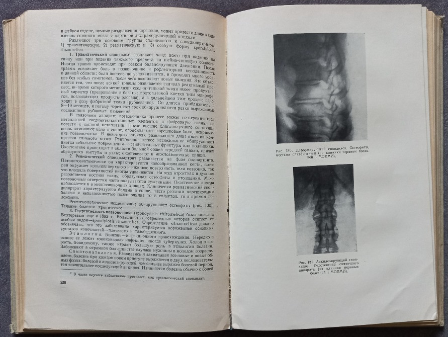 Нервные болезни. Е. К. Сепп, М. Б. Цукер, Е. В. Шмидт Харків - зображення 5