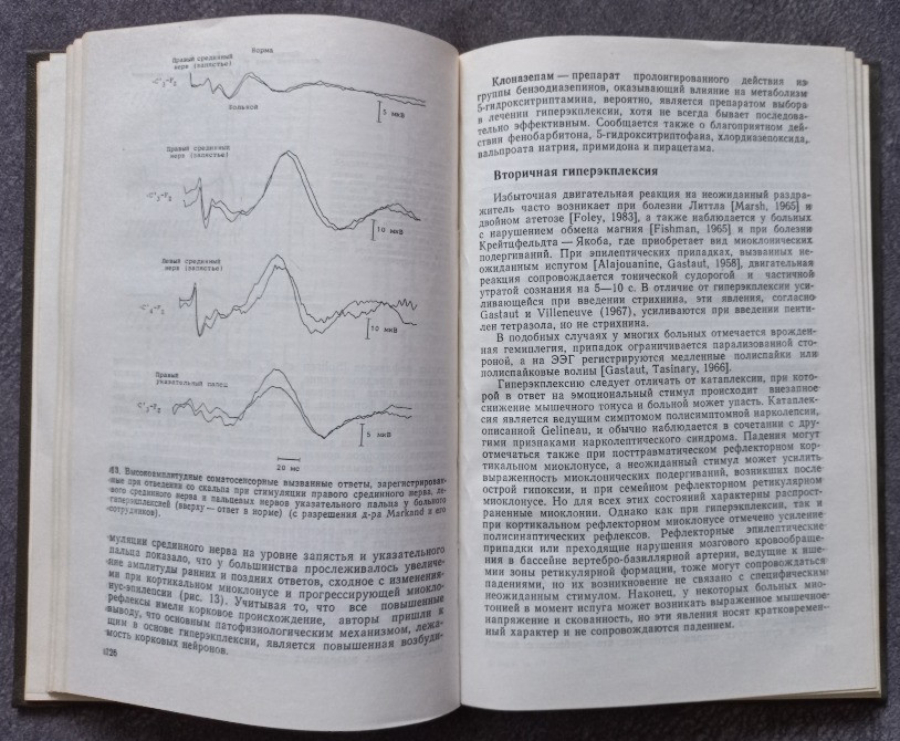 Тики. А.Дж. Лис Харьков - изображение 5