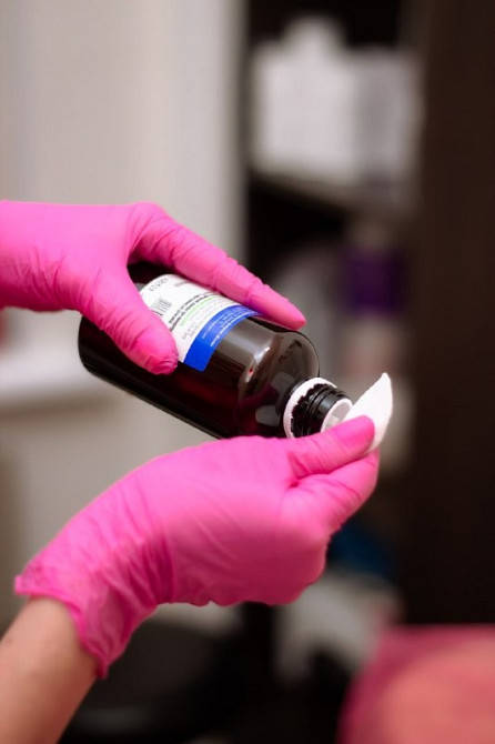 Лазерная эпиляция подмышек в Каменском! Київ - зображення 3