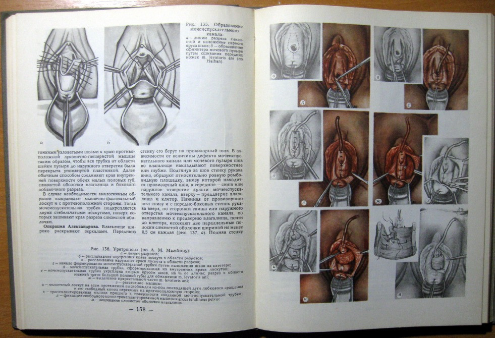 Атлас урогинекологических операций. Богодухів - зображення 3